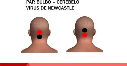 PAR-BULBO-CEREBELO
