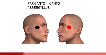 par canto canto