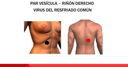par vesicula riñon derecho