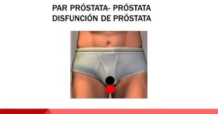 Próstata-Próstata