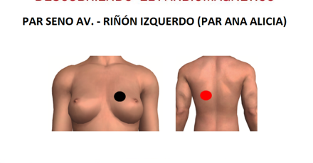 PAR SENO AV. - RIÑÓN IZQUERDO