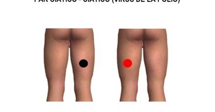 par ciatico ciatico