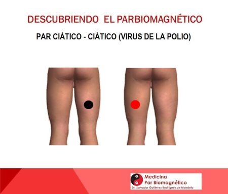 par ciatico ciatico