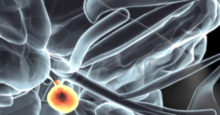 quistes en par biomagnetico
