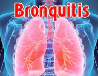Tratamiento de Bronquitis bacterianas y víricas con Biomagnetismo Tratamiento de Bronquitis bacterianas y víricas con Biomagnetismo