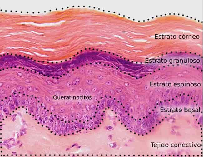 Caspa: Prevención y Tratamiento con Biomagnetismo caspa biomagnetismo